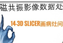 探究电脑影像错误的原因及解决方法（揭示电脑影像错误产生的内外因素以及有效解决方案）